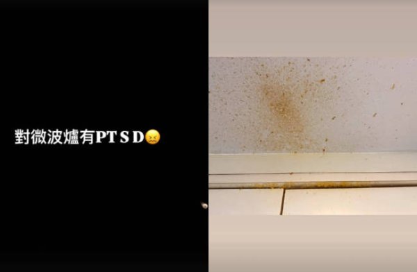 炒股配资10倍平台 女演员微波炉煮鸡蛋被炸伤眼睛：眼角膜破了个大洞